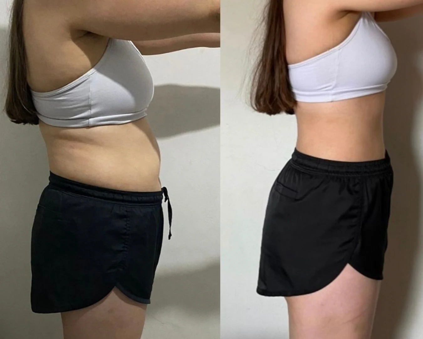 Before & After