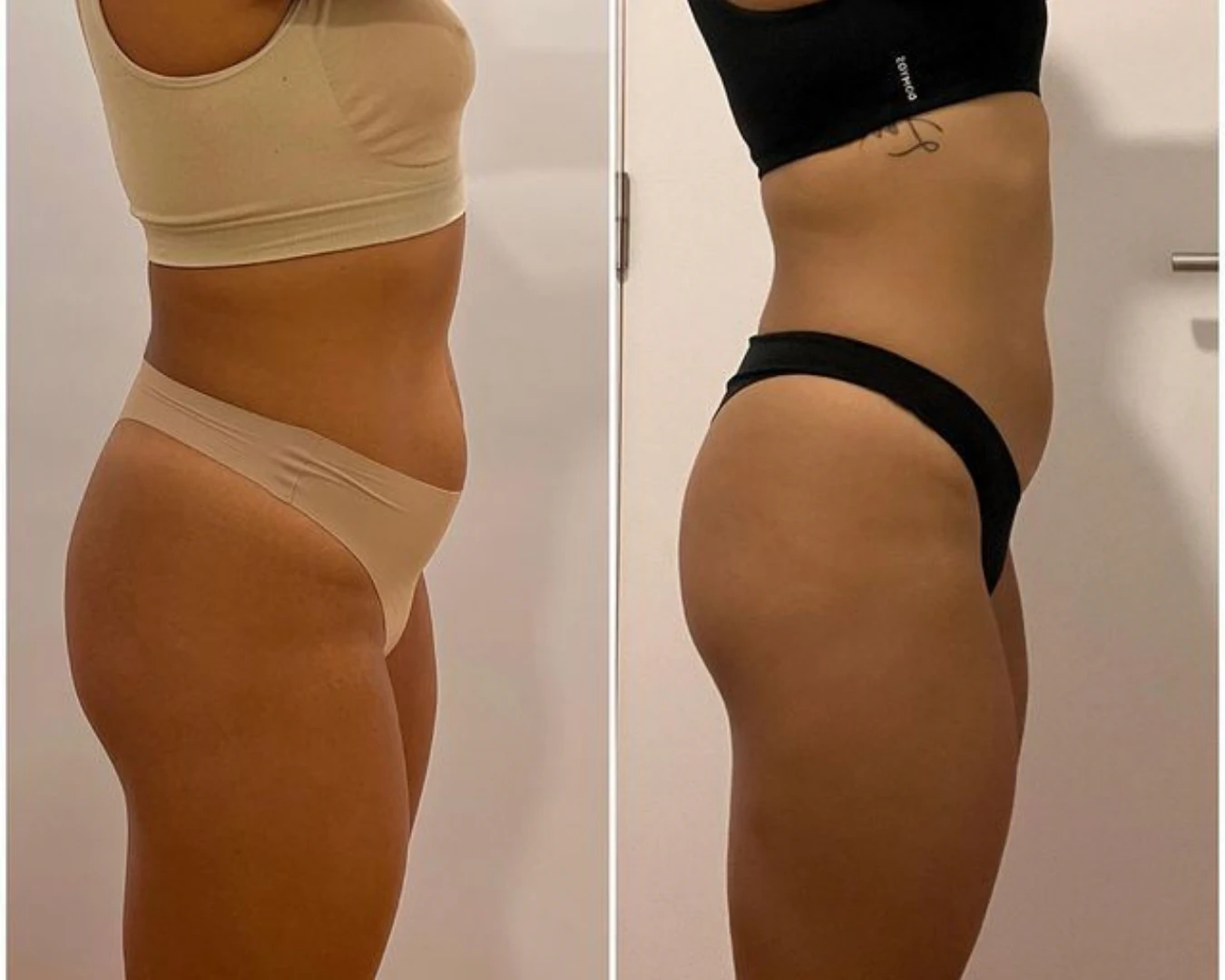 Before & After
